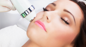 Laser Freckle Removal: Is It Right For You?